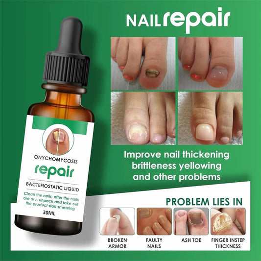 Original Natural Serum For Nail Health