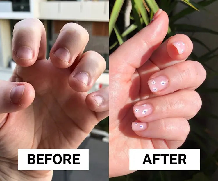 Original Natural Serum For Nail Health