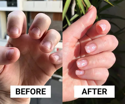 Original Natural Serum For Nail Health