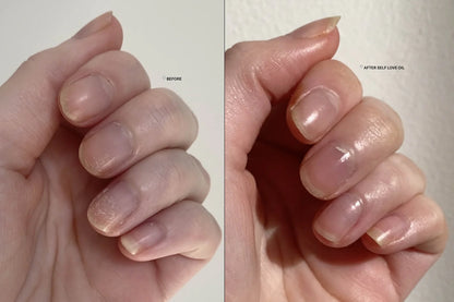 Original Natural Serum For Nail Health