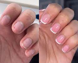 Original Natural Serum For Nail Health