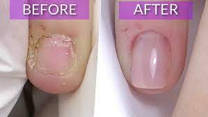Original Natural Serum For Nail Health