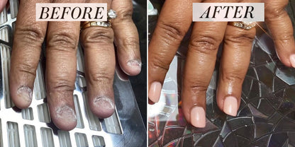 Original Natural Serum For Nail Health